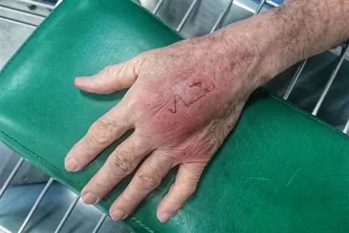 Mano mordida por gato que muestra signos de infección