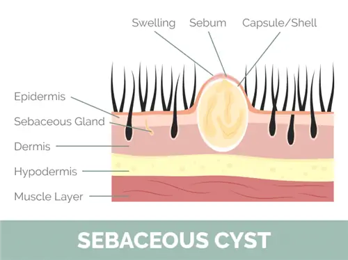 Paano Gamutin ang Sebaceous Cysts sa Mga Pusa: 6 na Mga Hakbang na Inaprubahan ng Vet