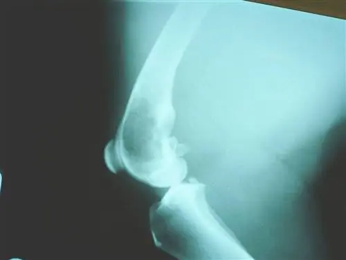 Osteosarcoma caní